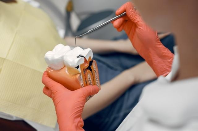 What You Need to Know About All-on-4 Dental Implants